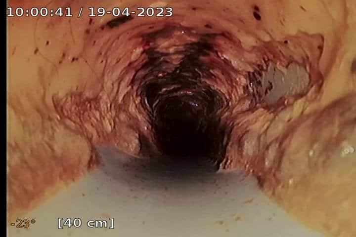 שטיפת קווי ביוב