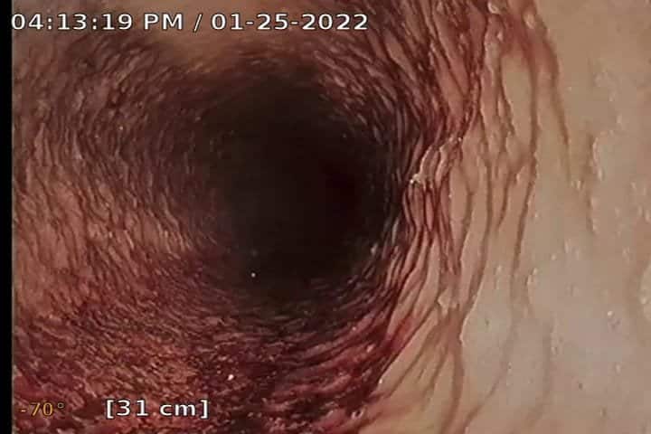 שטיפת קווי ביוב