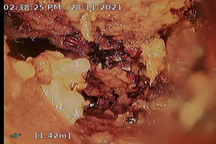 שטיפת קווי ביוב